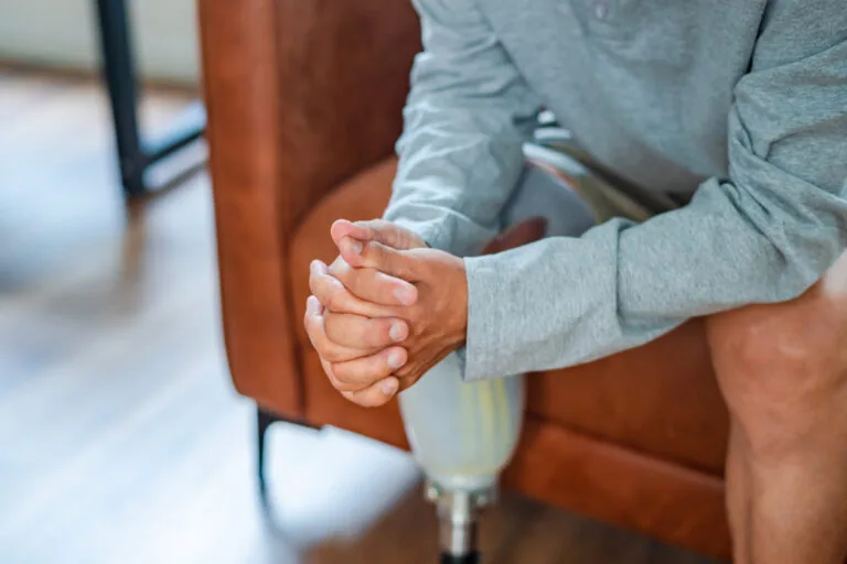 Disabled man wearing a prosthetic leg sitting on sofa at home, unrecognizable person